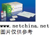 金标渗滤法检测试剂/呼吸道合胞病毒（RSV）抗体 IgG/M 40T 型号:WKHS-FXD	 库号：M388457