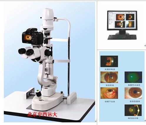 数字化裂隙灯分析系统 型号:CQKH-LS-5