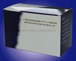 艾滋病检测试剂盒 中国