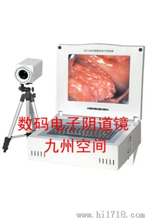 数码电子阴道镜生产，产品型号： JZ-6000B型