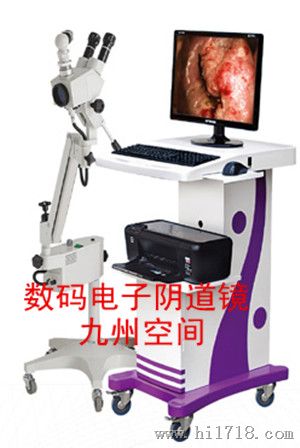 光电一体数码电子阴道镜生产，产品型号：JZ-6000C型